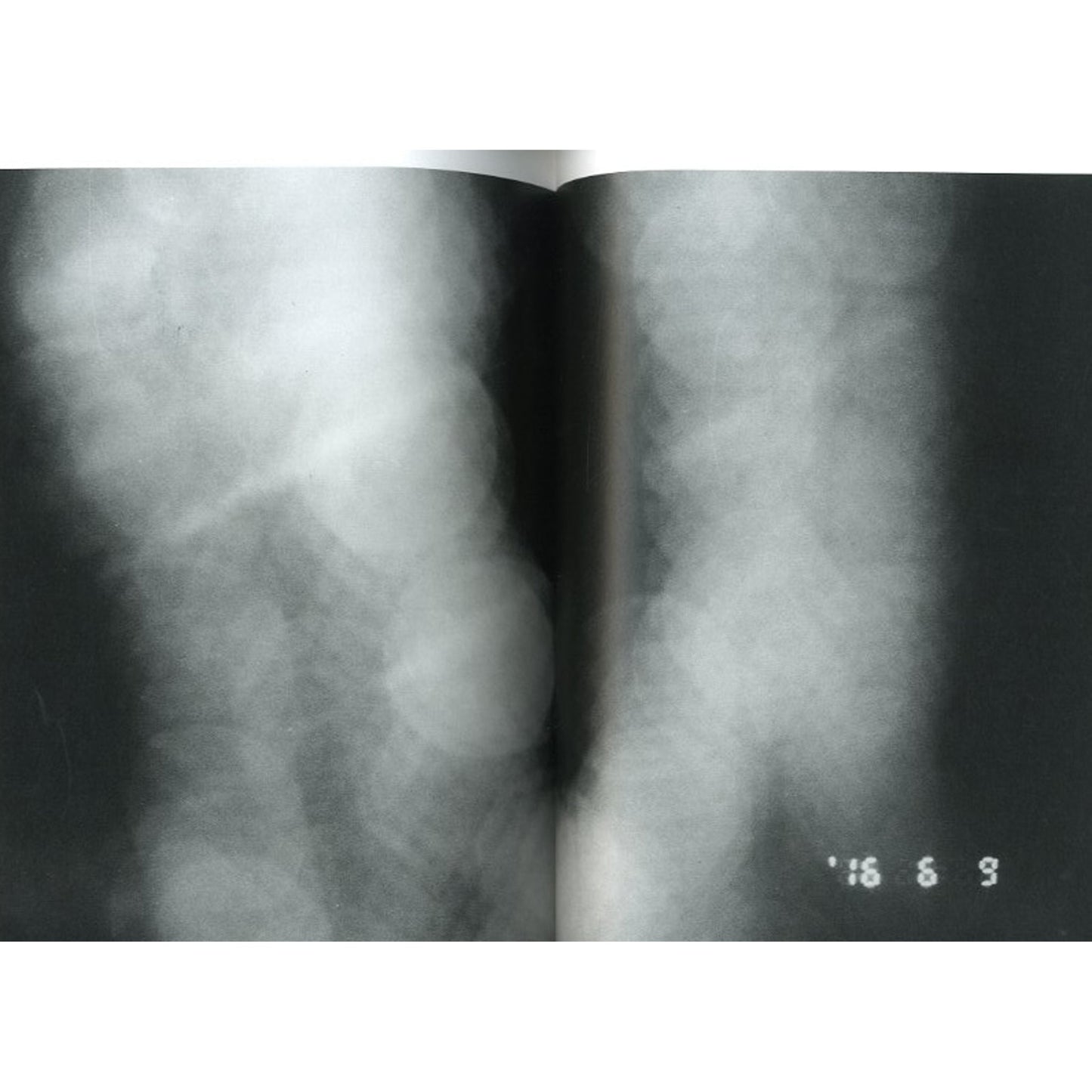 123死後69 写経老人A日記
